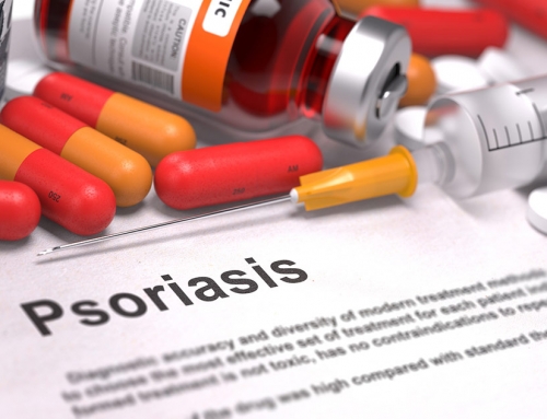 Topical Steroid Addiction (TSA) – Psoriasis, Seborrheic Dermatitis, and Atopic Dermatitis – 3/8